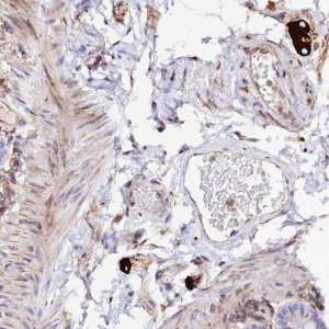 Anti-TRPV2 antibody produced in rabbit 