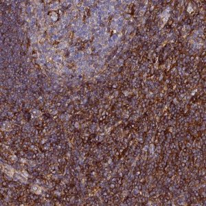 Anti-TRPV2 antibody produced in rabbit 