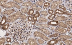 Anti-TSC2 Antibody, clone 4H10 ZooMAb Rabbit Monoclonal 