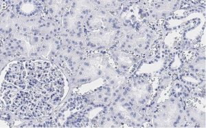 Anti-TSC2 Antibody, clone 4H10 ZooMAb Rabbit Monoclonal 
