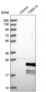 Anti-TSEN15 antibody produced in rabbit HPA029237-100UL