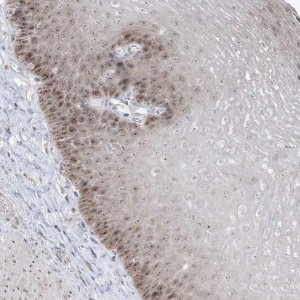 Anti-TSEN15 antibody produced in rabbit HPA029237-100UL