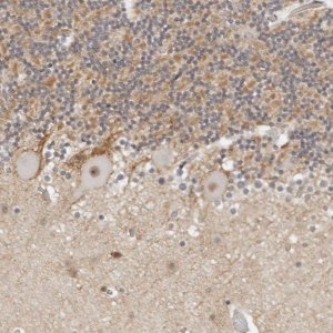 Anti-TSEN2 antibody produced in rabbit 