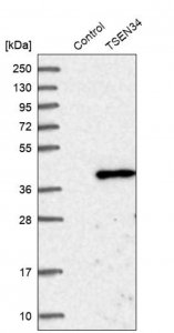 Anti-TSEN34 antibody produced in rabbit 