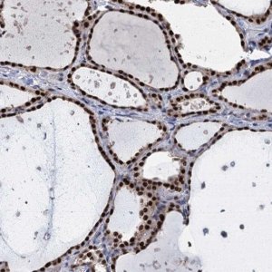 Anti-TSEN34 antibody produced in rabbit 