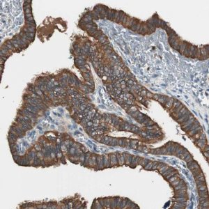 Anti-TSG101 antibody produced in rabbit 