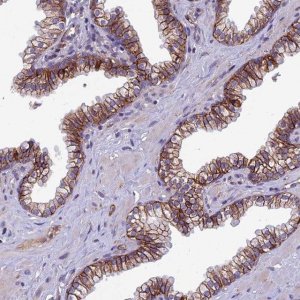 Anti-TSPAN15 antibody produced in rabbit 