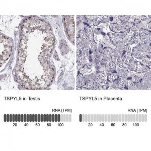 Anti-TSPYL5 antibody produced in rabbit 