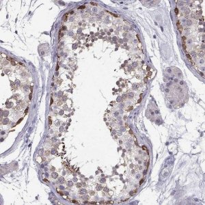 Anti-TSPYL5 antibody produced in rabbit 