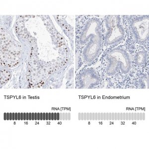 Anti-TSPYL6 antibody produced in rabbit 