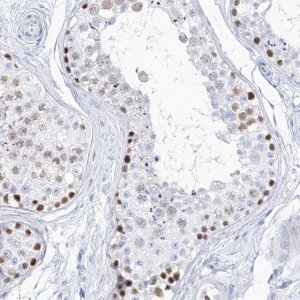 Anti-TSPYL6 antibody produced in rabbit 
