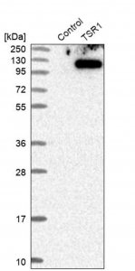 Anti-TSR1 antibody produced in rabbit HPA024434-100UL