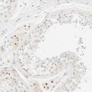Anti-TSR1 antibody produced in rabbit HPA024434-100UL