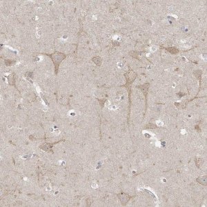 Anti-TSSC1 antibody produced in rabbit 