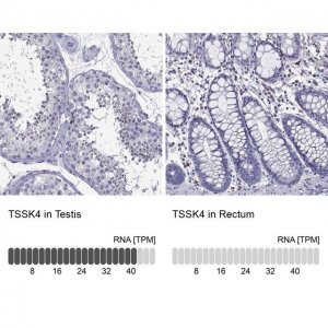 Anti-TSSK4 