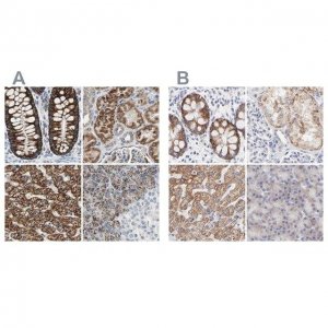 Anti-TST antibody produced in rabbit 