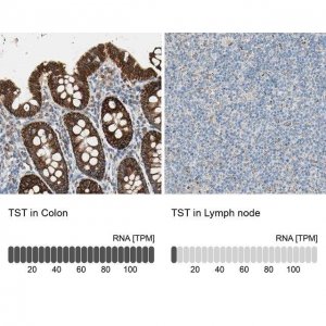 Anti-TST antibody produced in rabbit 