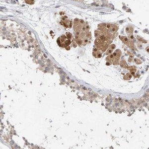 Anti-TSTA3 antibody produced in rabbit HPA023361-100UL