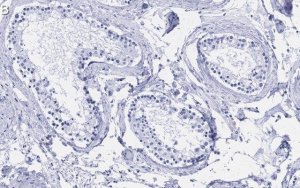 Anti-TSTA3 Antibody, clone 2N10-H1 ZooMAb Rabbit Monoclonal 
