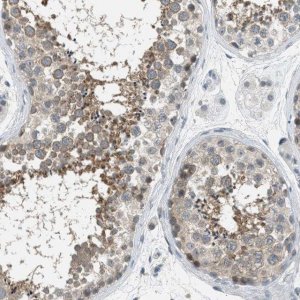 Anti-TTBK2 antibody produced in rabbit 