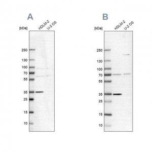 Anti-TTC19 antibody produced in rabbit 