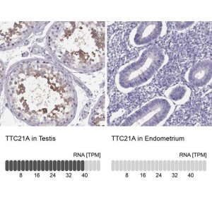 Anti-TTC21A antibody produced in rabbit 