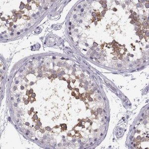 Anti-TTC21A antibody produced in rabbit 