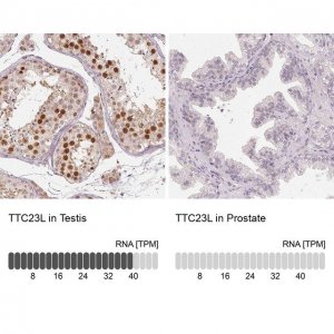 Anti-TTC23L antibody produced in rabbit 