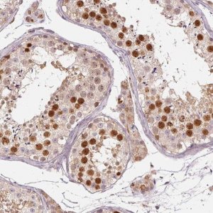 Anti-TTC23L antibody produced in rabbit 