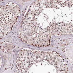 Anti-TTC33 antibody produced in rabbit HPA038252-100UL