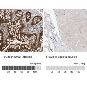 Anti-TTC38 antibody produced in rabbit 