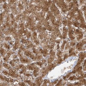 Anti-TTC38 antibody produced in rabbit 