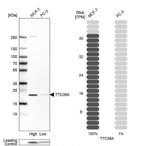 Anti-TTC39A antibody produced in rabbit 