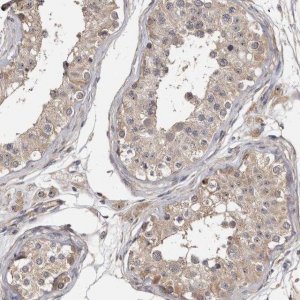 Anti-TTC39A antibody produced in rabbit 