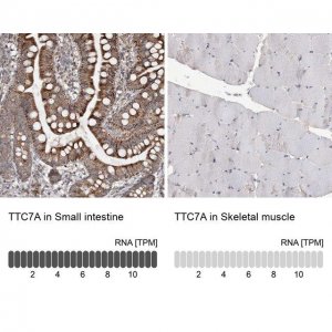 Anti-TTC7A antibody produced in rabbit 