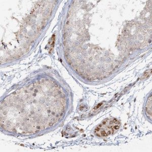 Anti-TTC7A antibody produced in rabbit 