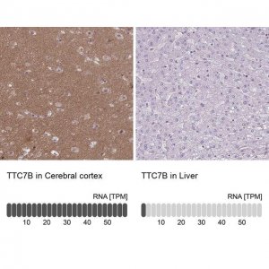 Anti-TTC7B antibody produced in rabbit 