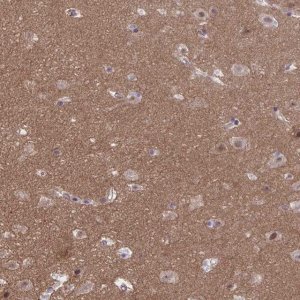 Anti-TTC7B antibody produced in rabbit 