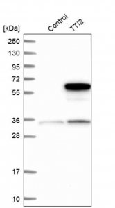 Anti-TTI2 antibody produced in rabbit 