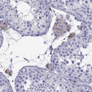 Anti-TTLL13P antibody produced in rabbit 