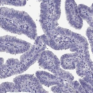 Anti-TTN antibody produced in rabbit 