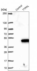 Anti-TTPAL antibody produced in rabbit 