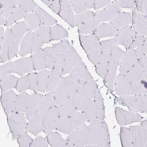 Anti-TTR antibody produced in rabbit HPA002550-100UL