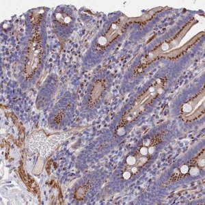 Anti-TUBGCP4 antibody produced in rabbit 
