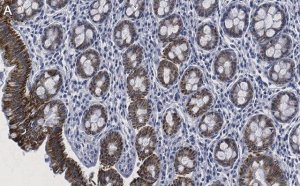 Anti-Tubulin -2 Antibody, clone 1M19 ZooMAb Rabbit Monoclonal 