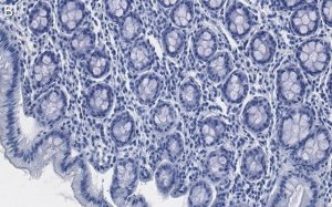 Anti-Tubulin -2 Antibody, clone 1M19 ZooMAb Rabbit Monoclonal 