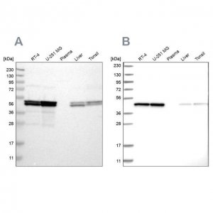 Anti-TUFM antibody produced in rabbit 