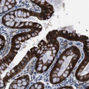 Anti-TULP3 antibody produced in rabbit HPA015285-100UL