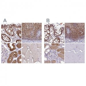 Anti-TXN antibody produced in rabbit 