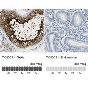 Anti-TXNDC2 antibody produced in rabbit 